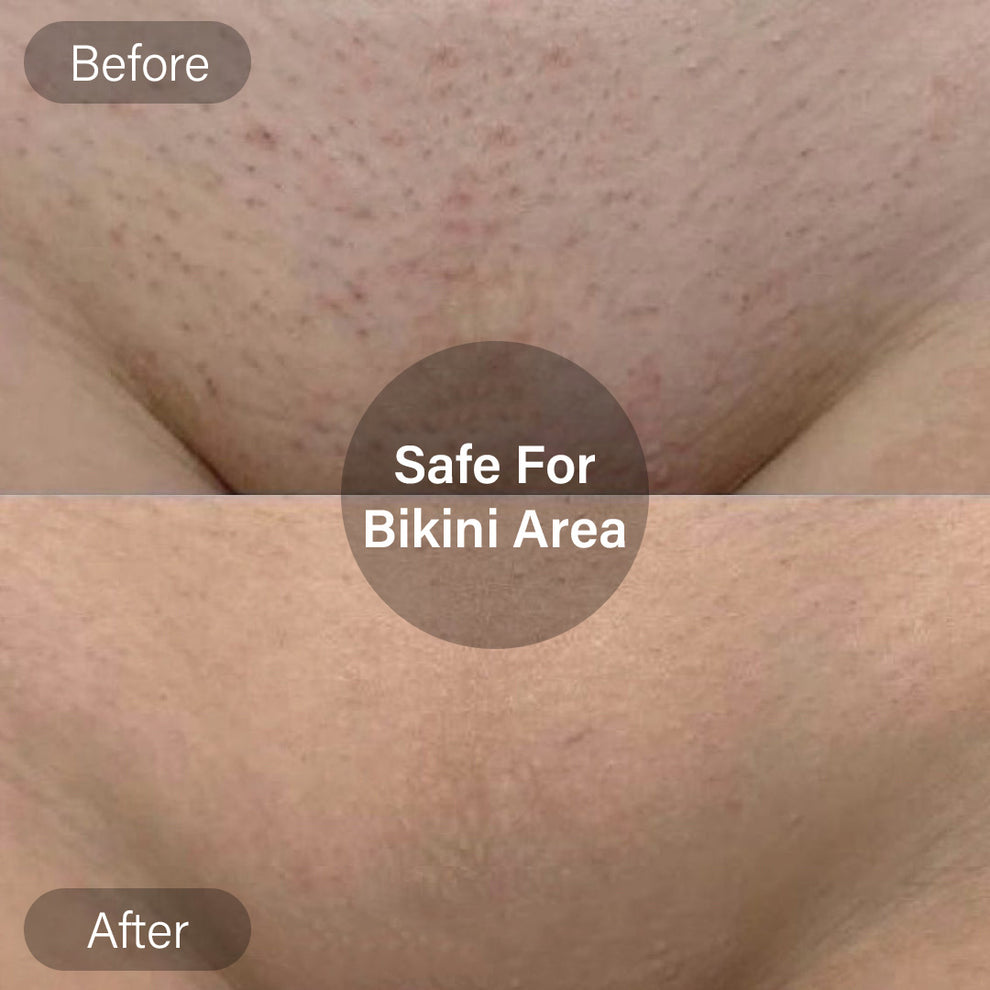 Aurela Vault™ Bikini Aura Trimmer