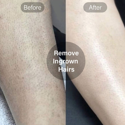 Aurela Vault™ Bikini Aura Trimmer